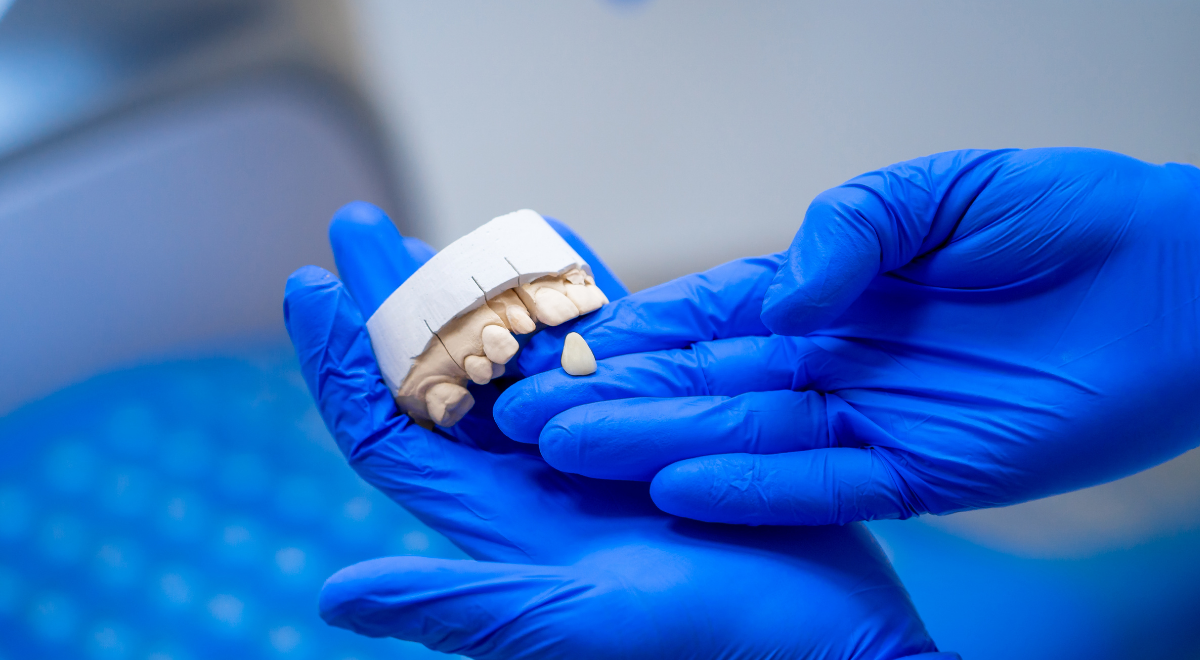 Estetica Dentale